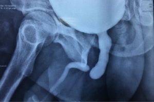 رتروگرید رتروگرید