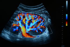 سونوگرافی کالر داپلر سونوگرافی کالر داپلر