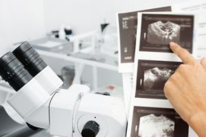 هیستروسونوگرافی هیستروسونوگرافی