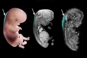 سونوگرافی NT سونوگرافی NT