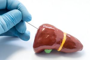 نمونه برداری کبد نمونه برداری کبد