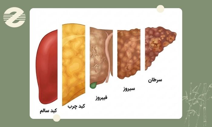 آیا خونریزی گوارشی در بیماران کبدی خطرناک است؟