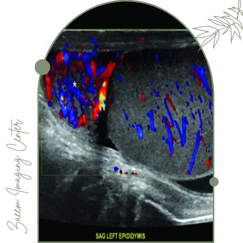 آیا سونوگرافی رنگی خطر دارد؟