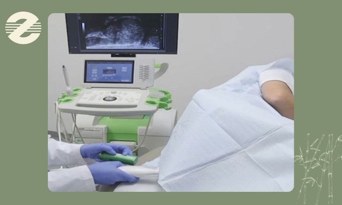 آیا نمونه ‌برداری پروستات درد دارد؟