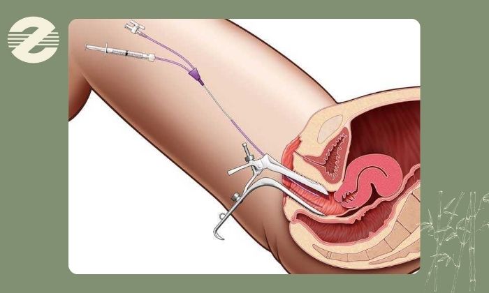 بهترین زمان انجام عکس رنگی رحم 