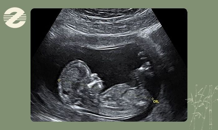 تعداد دفعات مجاز اولتراسوند در دوران بارداری