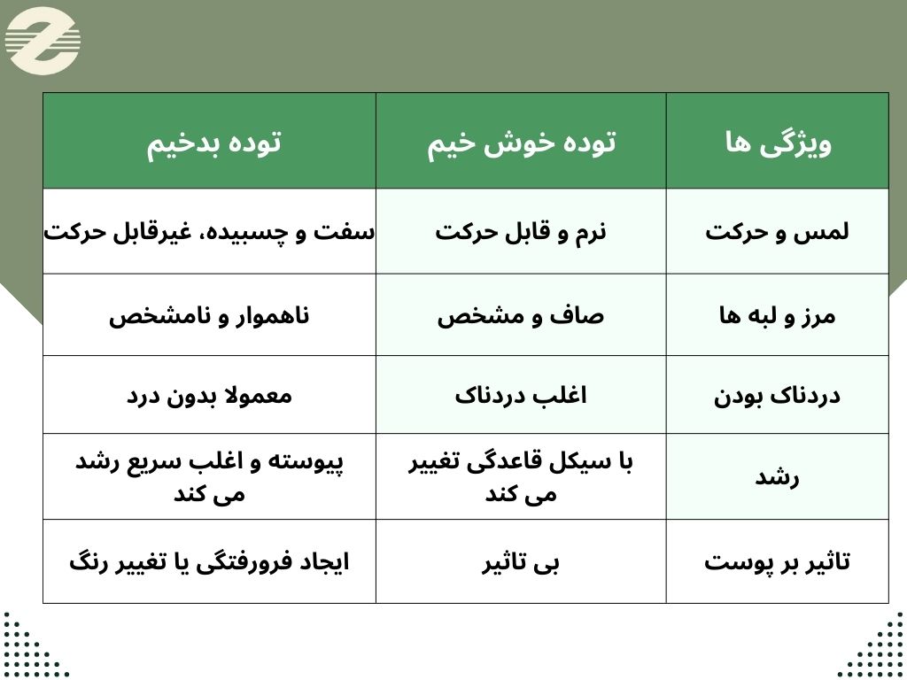 تفاوت ‌های توده خوش‌خیم و بدخیم