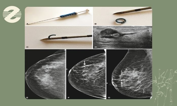 در چه مواردی نشانه گذاری انجام می‌ شود؟