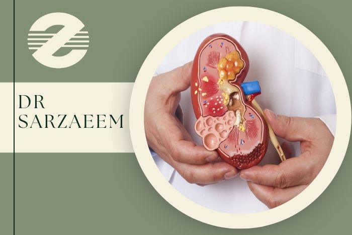 درد پهلو بعد از پیوند کلیه نشانه چیست و چه اهمیتی دارد؟