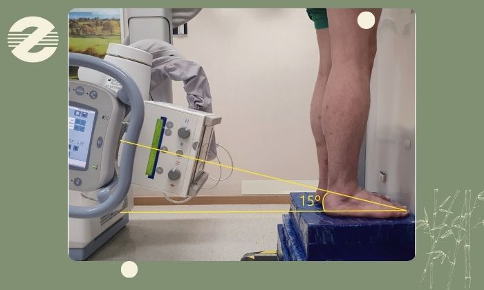 رادیوگرافی چگونه انجام می‌شود؟