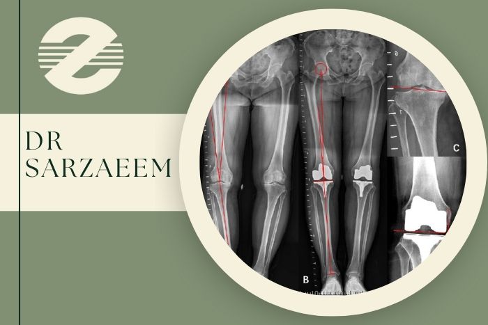 رادیوگرافی الایمنت ویو چیست و در کرج کجا انجام می شود؟