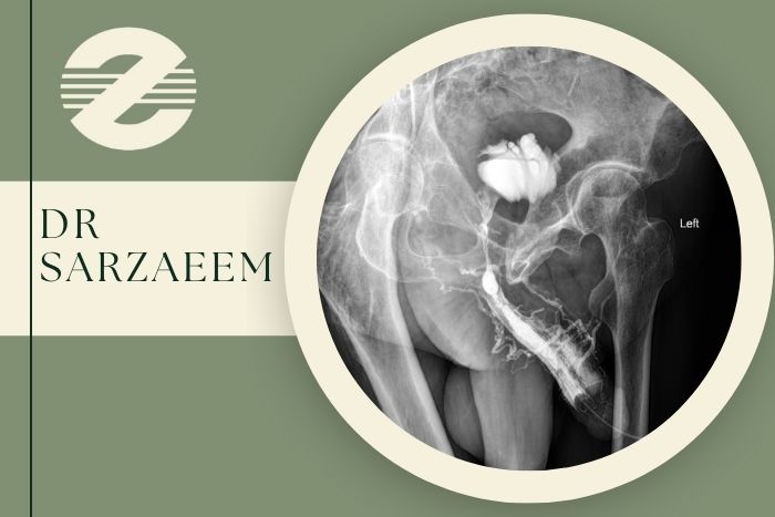 رتروگرید (RUG) چیست و چرا انجام می ‌شود؟