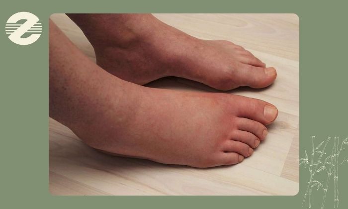 چه زمانی لازم است برای بررسی عروق اقدام کنیم؟