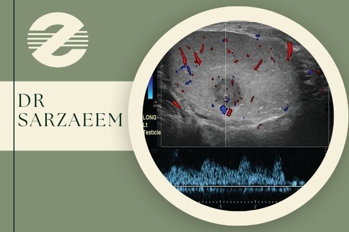 سونوگرافی کالر داپلر بیضه چیست و در کرج کجا انجام می‌ شود؟