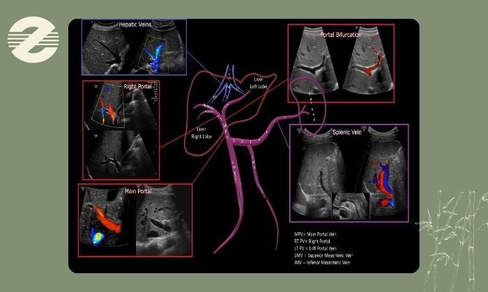 سونوگرافی کالر داپلر پورت چیست؟