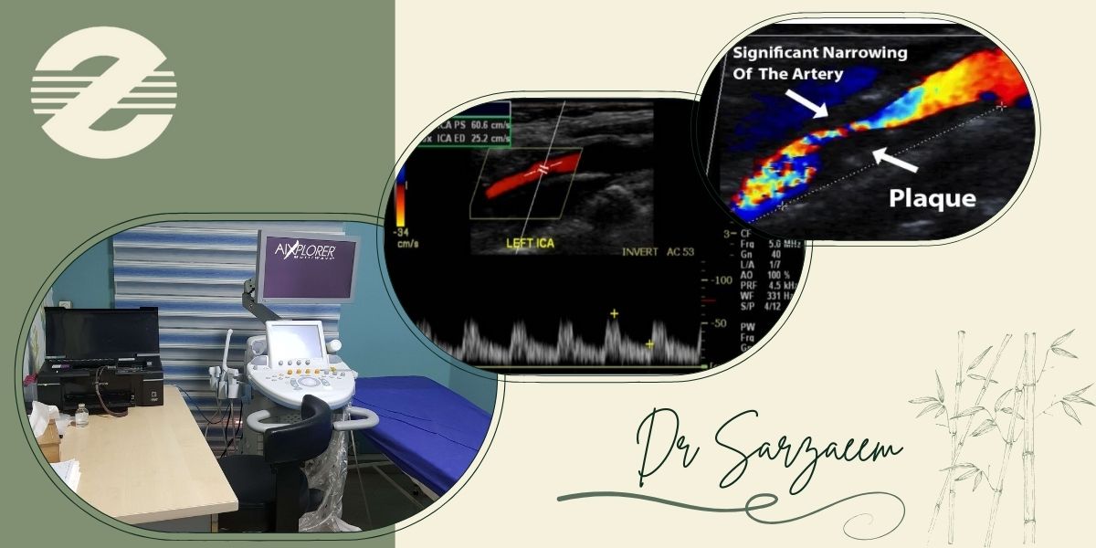 سونوگرافی کالر داپلر کاروتید در کرج کجا انجام می‌شود؟