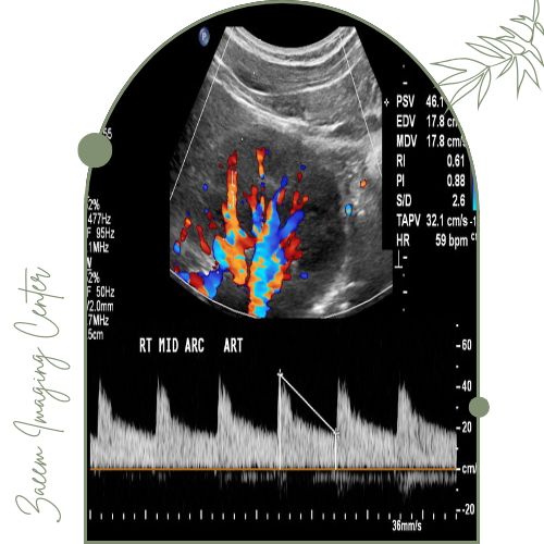 سونوگرافی کالر داپلر کلیه چیست؟