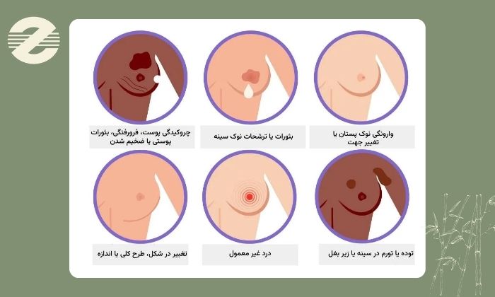 علائم هشداردهنده درد و تورم سینه علائم هشداردهنده درد و تورم سینه