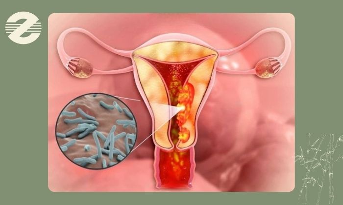 علل ایجاد چسبندگی