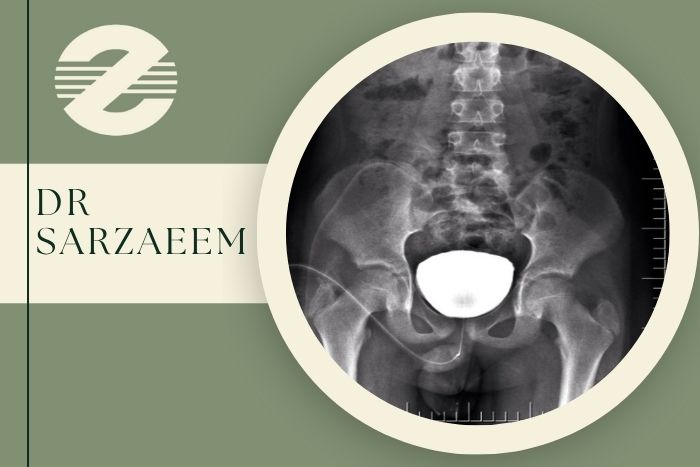 عکس رنگی مثانه (VCUG) چیست و در کرج کجا انجام می ‌شود؟