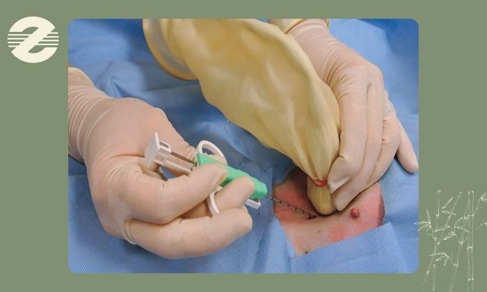 مراحل انجام مارکرگذاری