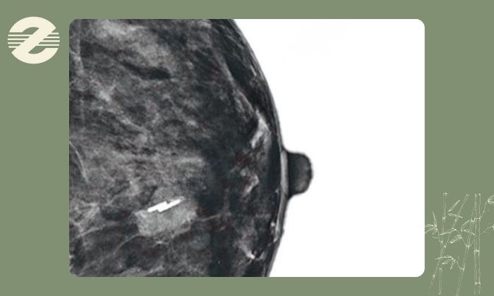 مراقبت ‌ها و توصیه ‌های مهم 