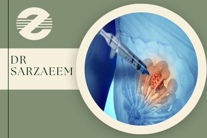 مراقبت‌ های مهم بعد از نمونه برداری پستان که باید بدانید