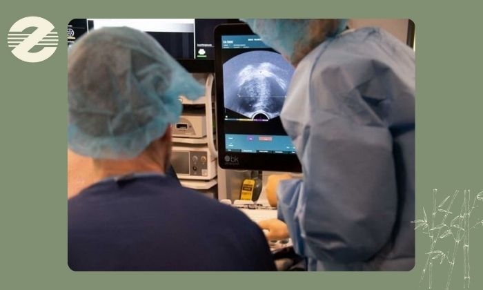 مزایای انجام بیوپسی پروستات