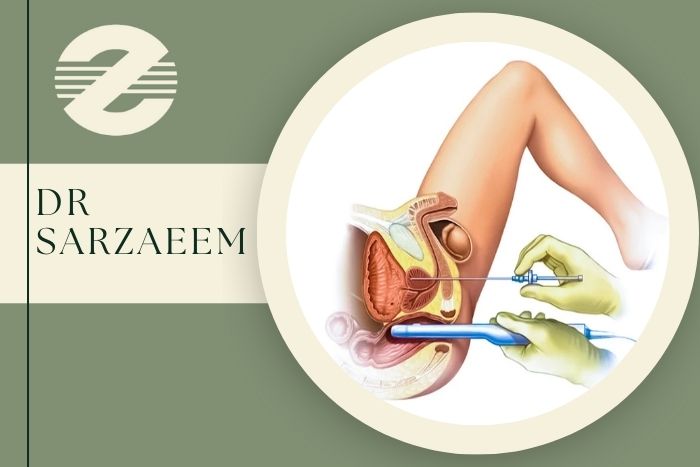 نمونه ‌برداری پروستات چگونه انجام می ‌شود و آیا درد دارد؟