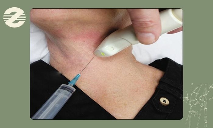 نمونه‌ برداری چگونه انجام می شود؟