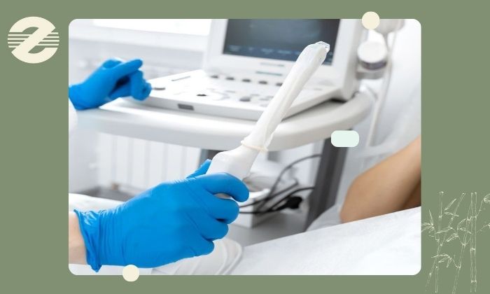 نکات مهم قبل از انجام سونوگرافی 