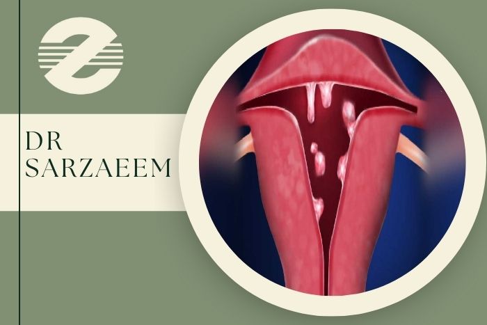 پولیپ رحم چطور باعث خونریزی غیر طبیعی می ‌شود؟