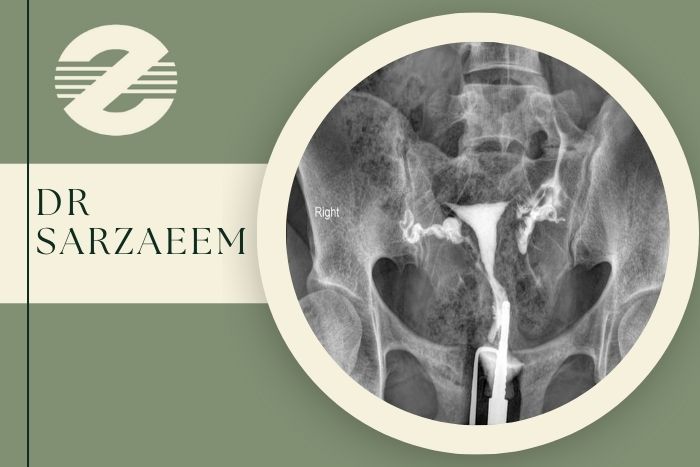 چه زمانی بهترین موقع برای انجام عکس رنگی رحم است؟