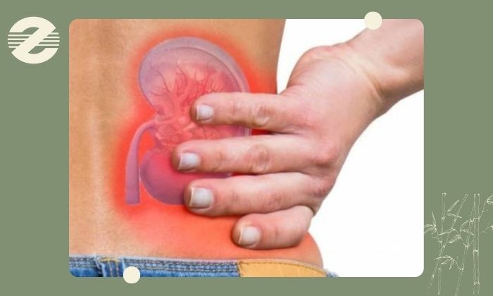 چه زمانی درد پهلو بعد از پیوند رنال خطرناک است؟