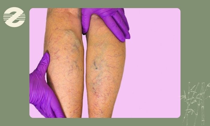 چه مشکلاتی با این تست مشخص می‌شود؟