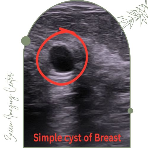 کاربردهای داپلر پستان در تشخیص بیماری‌ ها