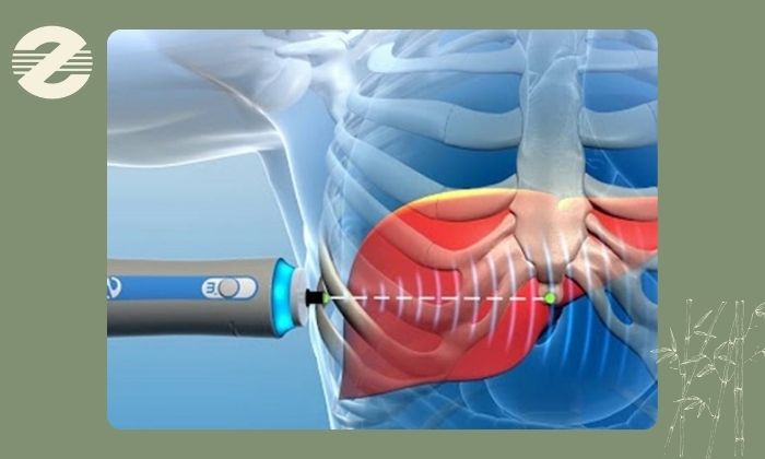 تشخیص مشکلات کبدی تشخیص مشکلات کبدی