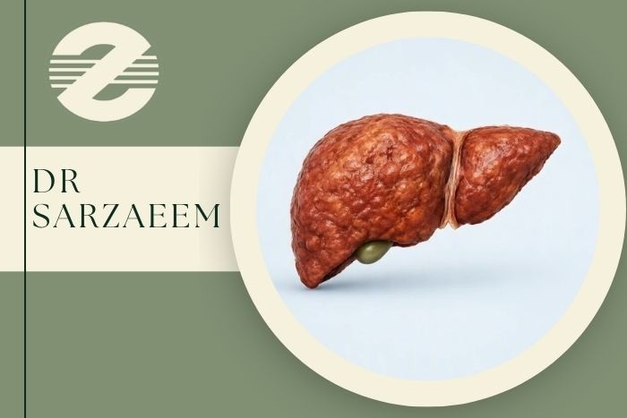 چه نشانه‌هایی خطر سیروز کبد را بالا می‌برد؟ 