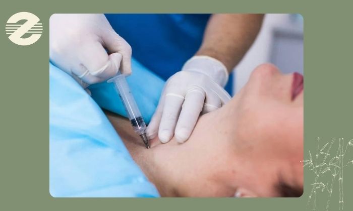 بعد از نمونه‌برداری تیروئید چه تغییراتی در پوست دیده می‌شود؟