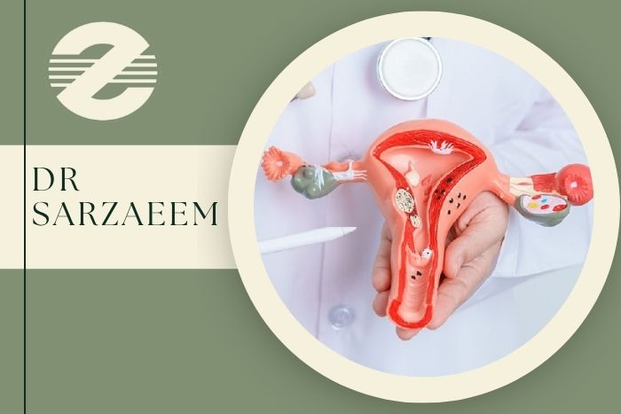 بهترین زمان سونوگرافی برای تشخیص اندومتریوز چه موقع است؟ 