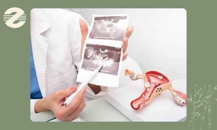 بهترین روشهای تشخیص میوم رحم بهترین روشهای تشخیص میوم رحم