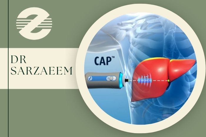 قبل از فیبرو اسکن کبد چه آمادگی‌هایی لازم است؟