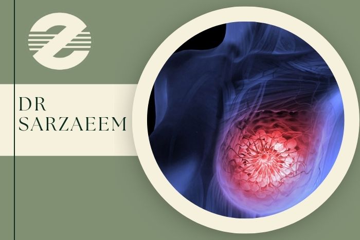 وقتی ضایعه پستان قابل لمس نیست تصمیم جراحی چگونه گرفته می‌شود؟